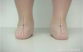 扁平足能踢好足球吗，扁平足能踢好足球吗视频